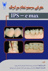 معرفی سیستم تمام سرامیک IPS e‌max