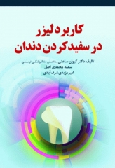 کاربرد لیزر در سفید کردن دندان