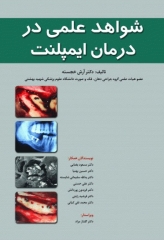 شواهد علمی در درمان ایمپلنت دکتر آرش خجسته