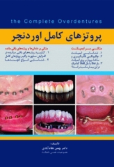 پروتزهای کامل اوردنچر