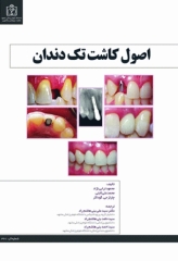 اصول کاشت تک دندان دکتر ترابی‌نژاد 2014