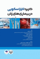 کاربرد لاپاراسکوپی در بیماری‌های زنان