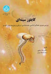 کایفوز سینه‌ای