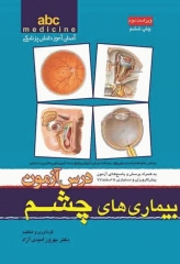 آسان آموز پزشکی abc medicine درس آزمون بیماری‌های چشم