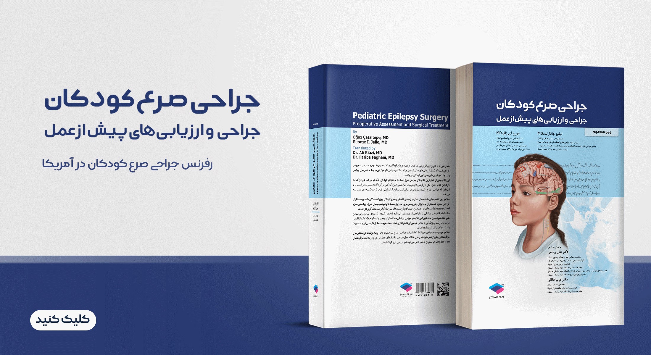 جراحی صرع کودکان