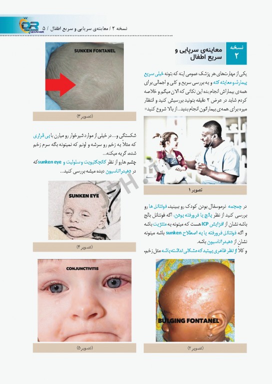 صفر تا صد نسخه نویسی اطفال به زبان ساده و خودمانی