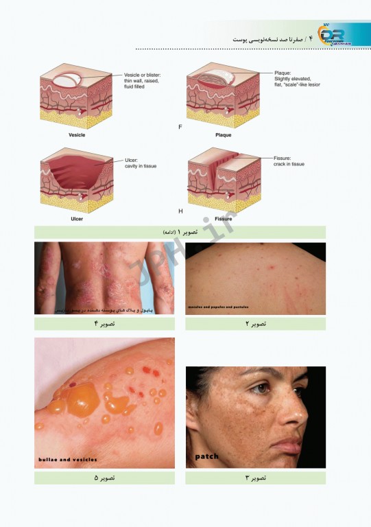 صفر تا صد نسخه نویسی پوست به زبان ساده و خودمانی