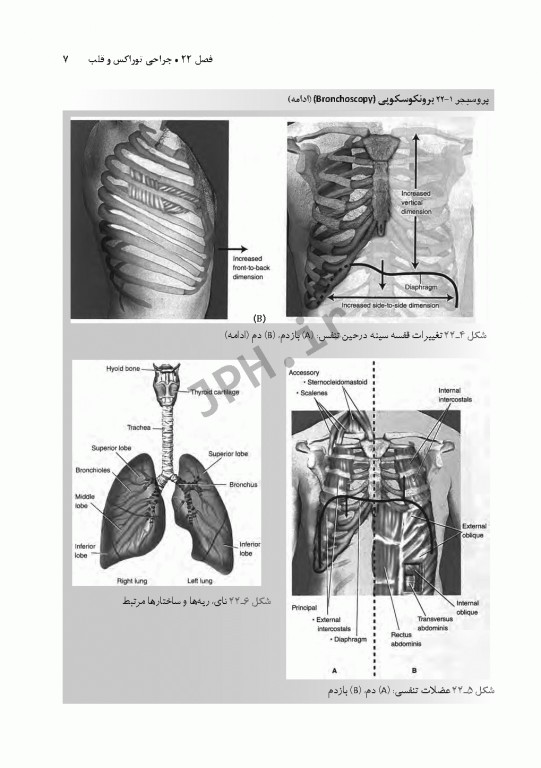 تکنولوژی جراحی برای تکنولوژیست جراحی 2018 جلد7 جراحی توراکس قلب و عروق