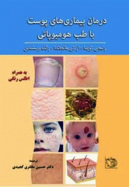 درمان بیماری‌های پوست با هومیوپاتی