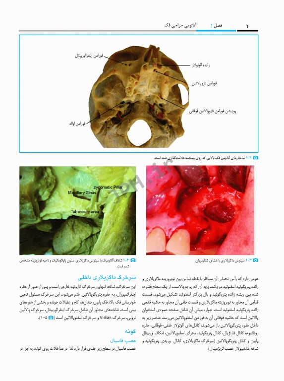 جراحی پیزوالکتریک دندان‌های نهفته