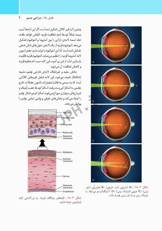 مراقبت از بیمار در جراحی الکساندر 2019 جلد4 جراحی چشم