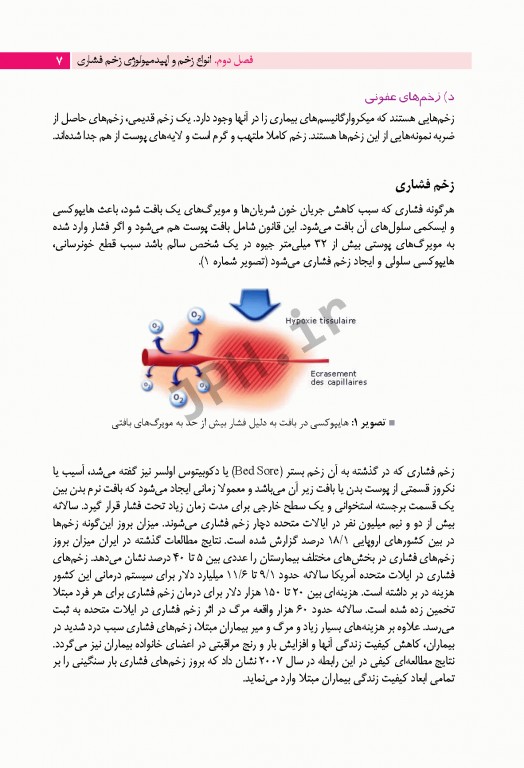 زخم فشاری پیشگیری، درمان و مراقبت‌های پرستاری