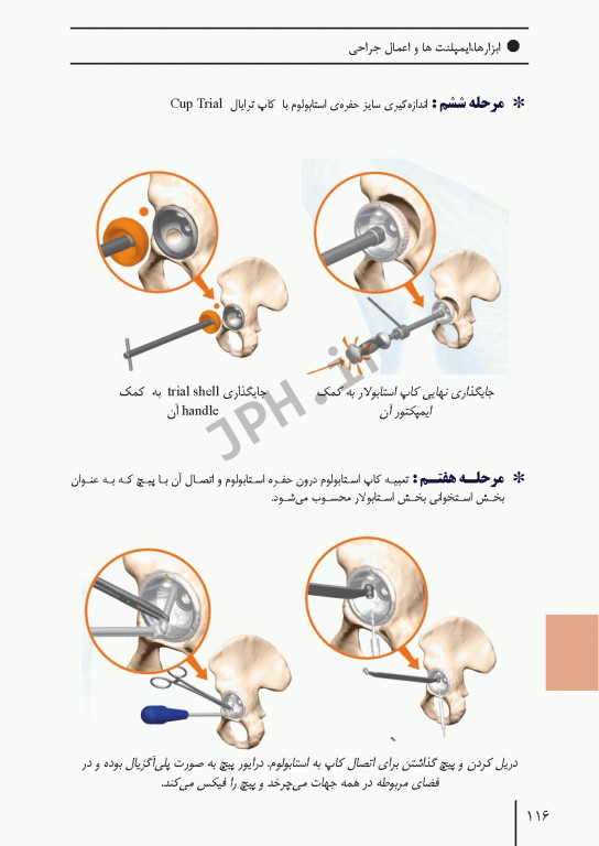 ابزارهای جراحی ایمپلنت‌های تخصصی و اعمال جراحی شایع ارتوپدی