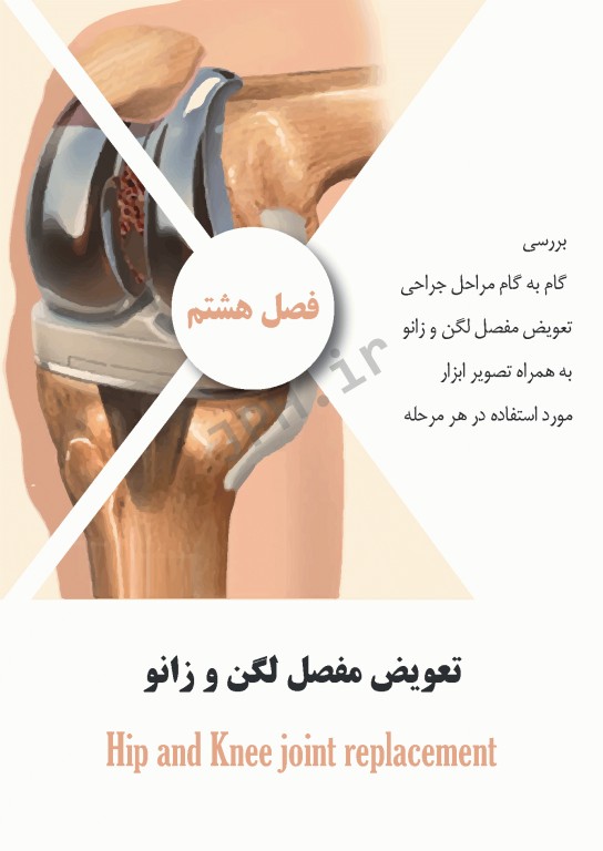 ابزارهای جراحی ایمپلنت‌های تخصصی و اعمال جراحی شایع ارتوپدی