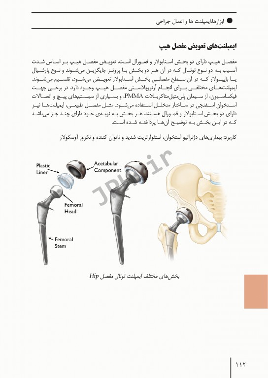 ابزارهای جراحی ایمپلنت‌های تخصصی و اعمال جراحی شایع ارتوپدی