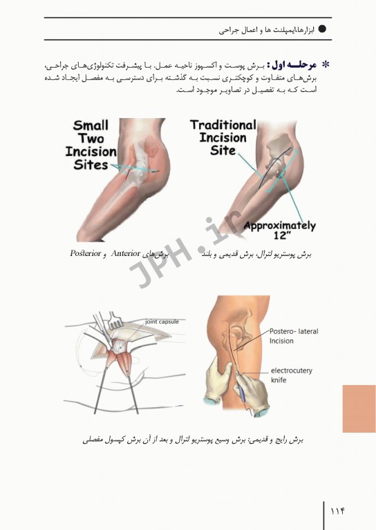 ابزارهای جراحی ایمپلنت‌های تخصصی و اعمال جراحی شایع ارتوپدی