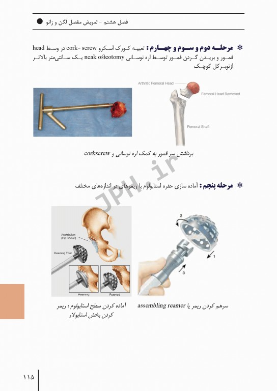 ابزارهای جراحی ایمپلنت‌های تخصصی و اعمال جراحی شایع ارتوپدی