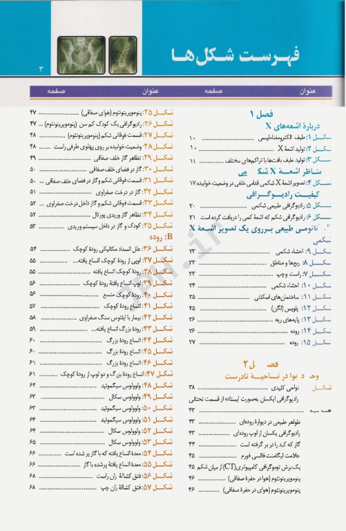 تفسیر تصاویر اشعه X شکم برای دانشجویان پزشکی