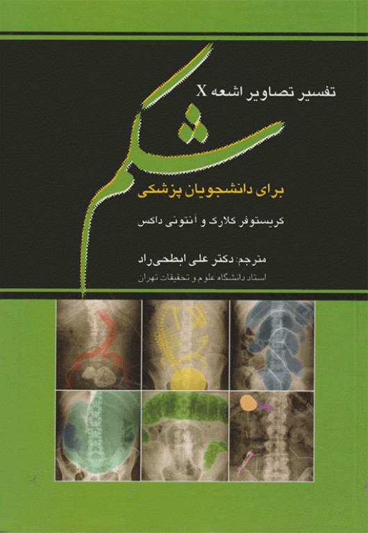 تفسیر تصاویر اشعه X شکم برای دانشجویان پزشکی