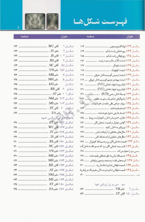 تفسیر تصاویر اشعه X شکم برای دانشجویان پزشکی