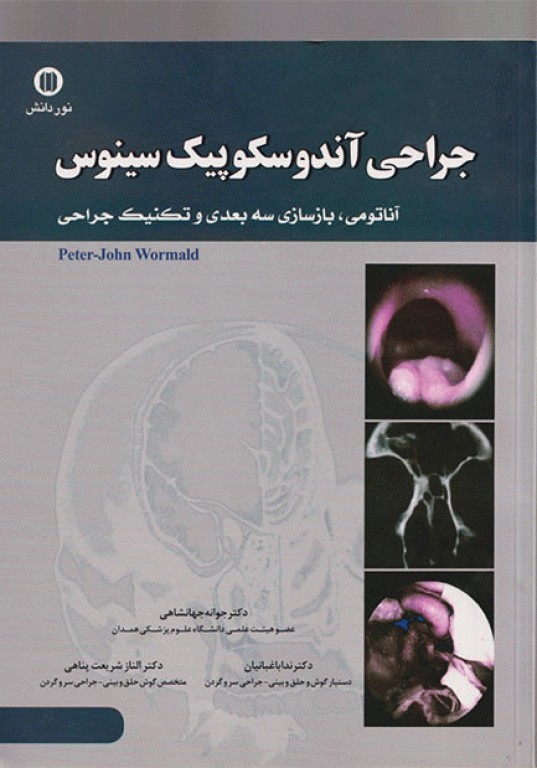 جراحی آندوسکوپیک سینوس آناتومی بازسازی سه بعدی و تکنیک جراحی