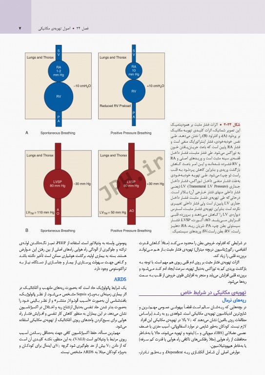 بیماری‌های ریوی کودکان کندیگ 2019 جلد3 بیماری‌های ریوی در بخش مراقبت‌های ویژه و آسم