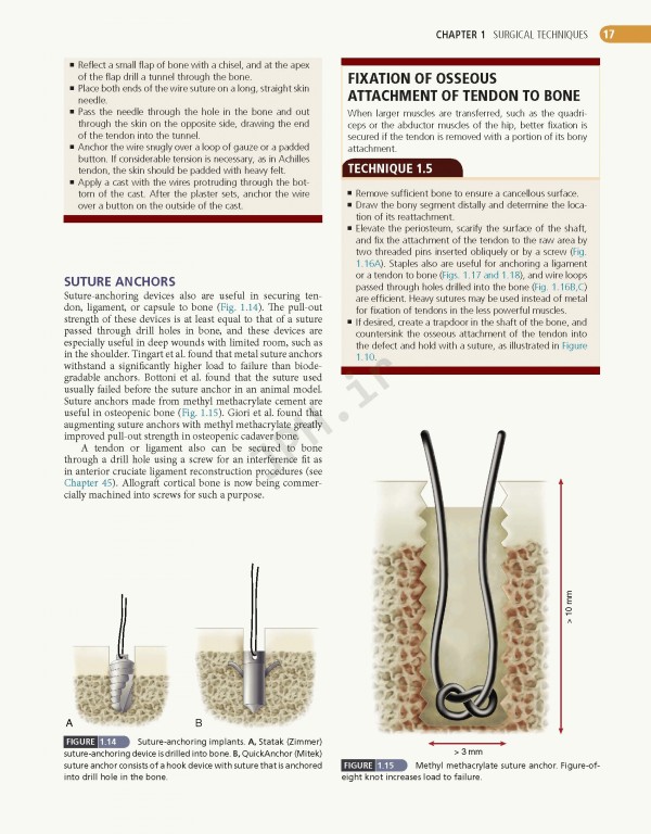 ارتوپدی عملی کمپبل 4جلدی 2021 | Campbell's Operative Orthopaedics 14th edition 4-volum