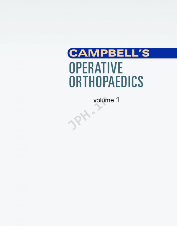 Campbell's Operative Orthopaedics 2017 13th edition 4-volum | ارتوپدی عملی کمپبل 4جلدی