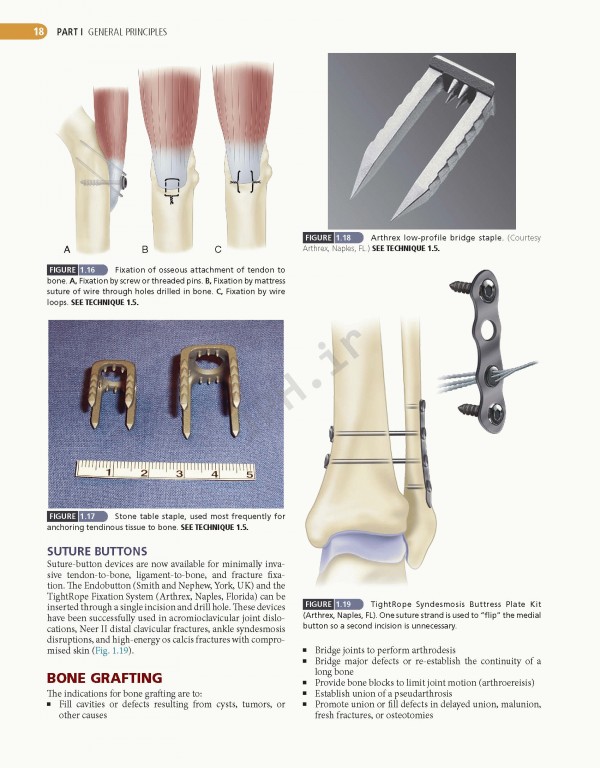 ارتوپدی عملی کمپبل 4جلدی 2021 | Campbell's Operative Orthopaedics 14th edition 4-volum