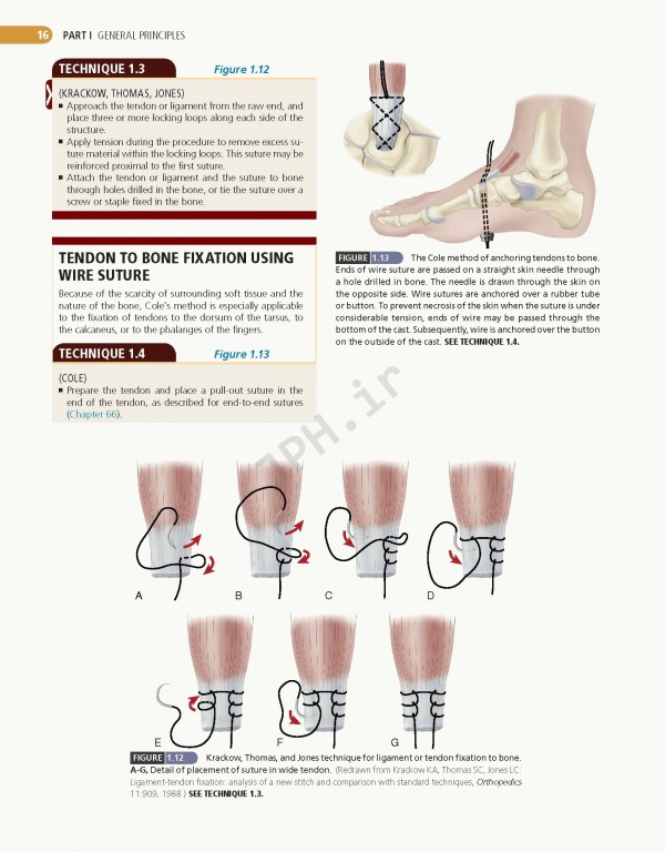 ارتوپدی عملی کمپبل 4جلدی 2021 | Campbell's Operative Orthopaedics 14th edition 4-volum