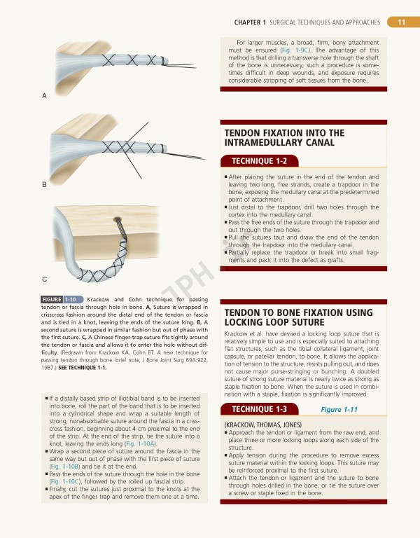Campbell's Operative Orthopaedics 2017 13th edition 4-volum | ارتوپدی عملی کمپبل 4جلدی