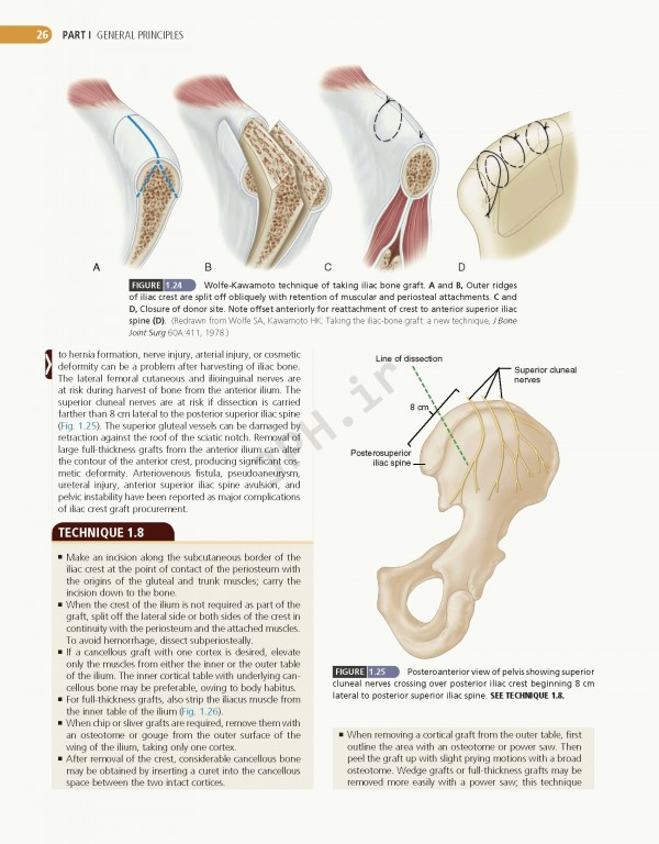 ارتوپدی عملی کمپبل 4جلدی 2021 | Campbell's Operative Orthopaedics 14th edition 4-volum