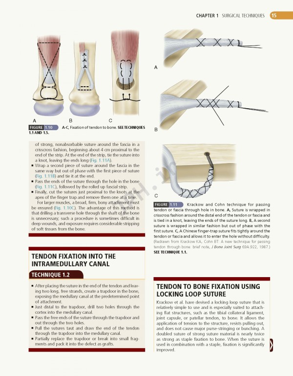 ارتوپدی عملی کمپبل 4جلدی 2021 | Campbell's Operative Orthopaedics 14th edition 4-volum