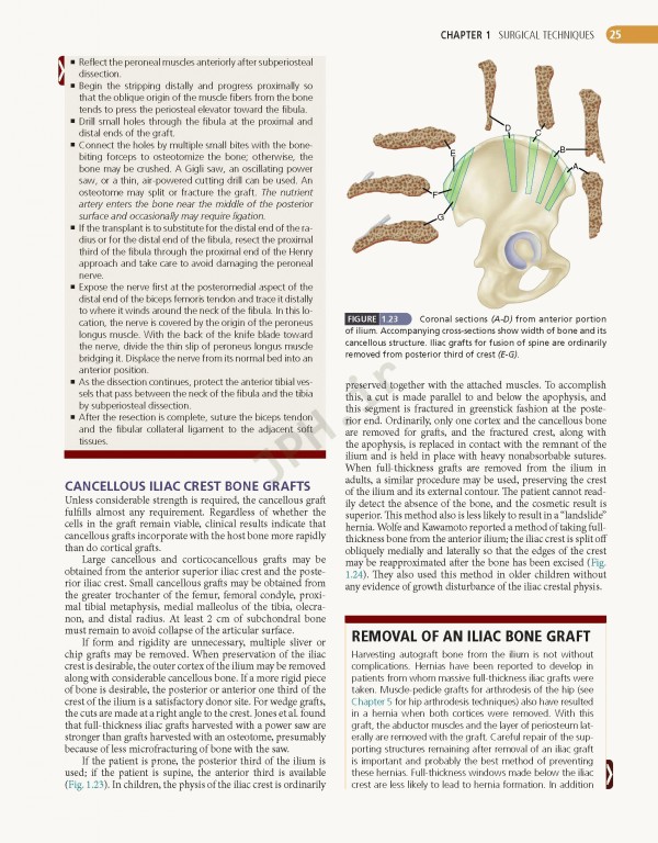 ارتوپدی عملی کمپبل 4جلدی 2021 | Campbell's Operative Orthopaedics 14th edition 4-volum