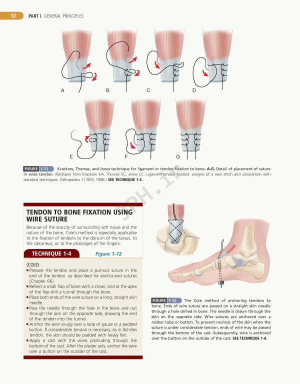 Campbell's Operative Orthopaedics 2017 13th edition 4-volum | ارتوپدی عملی کمپبل 4جلدی