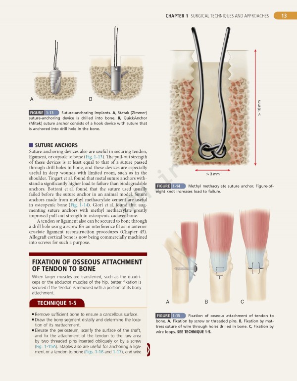 Campbell's Operative Orthopaedics 2017 13th edition 4-volum | ارتوپدی عملی کمپبل 4جلدی