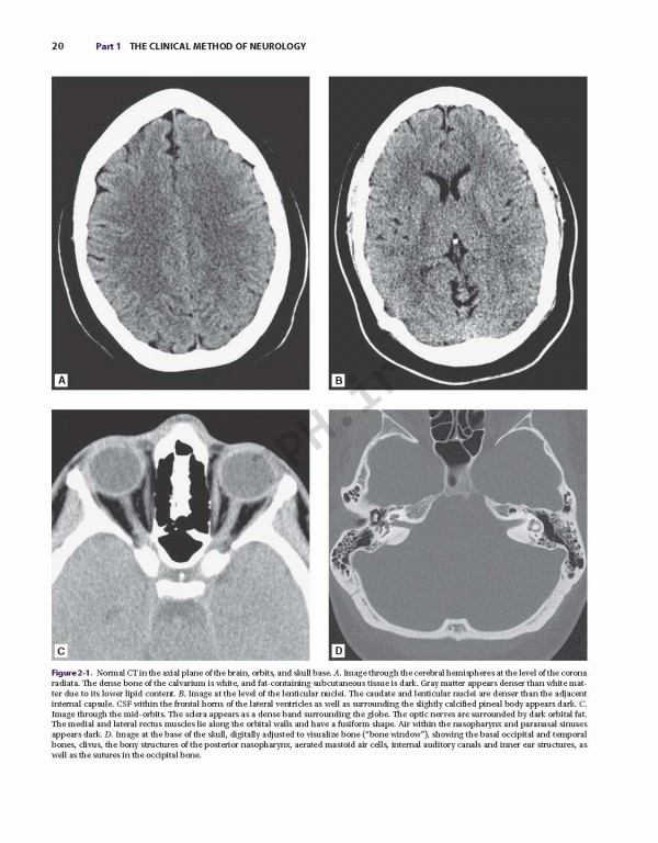 اصول مغز و اعصاب آدامز و ویکتور | Adams and Victor's Principles of Neurology 11th Edition 2019