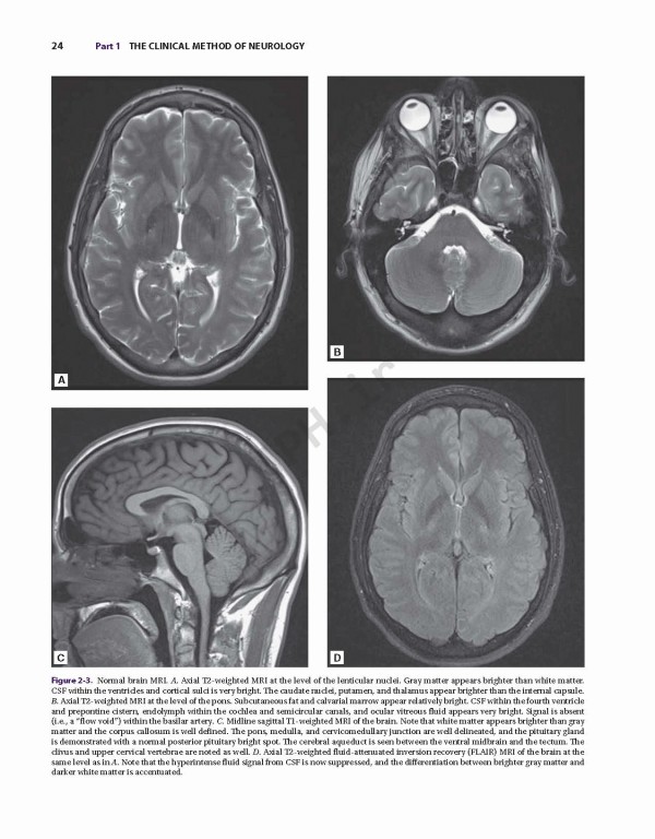اصول مغز و اعصاب آدامز و ویکتور | Adams and Victor's Principles of Neurology 11th Edition 2019
