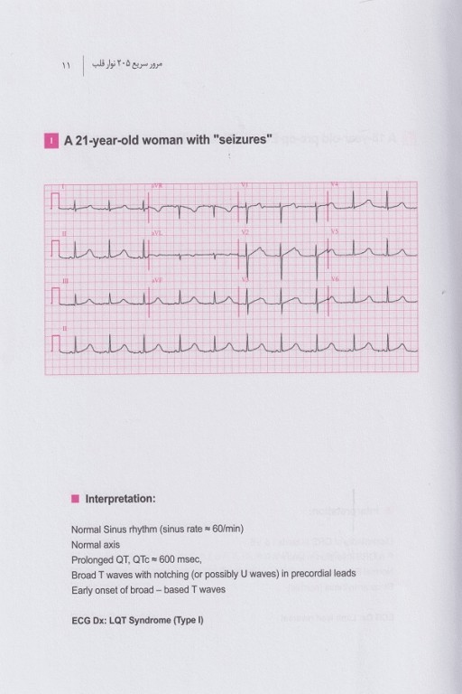 مرور سریع 205 نوار قلب