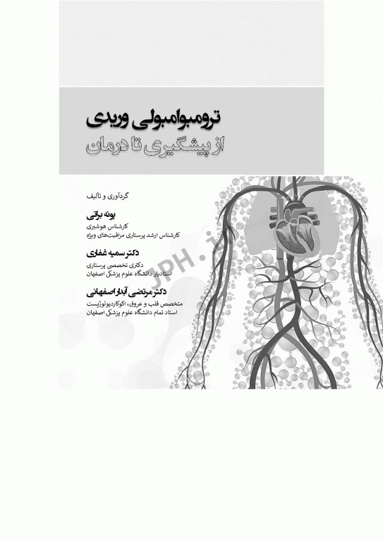 ترومبوامبولی وریدی از پیشگیری تا درمان