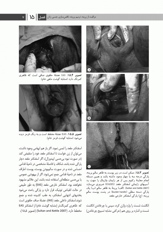 درسنامه مامایی مایلز 2014 جلد دوم