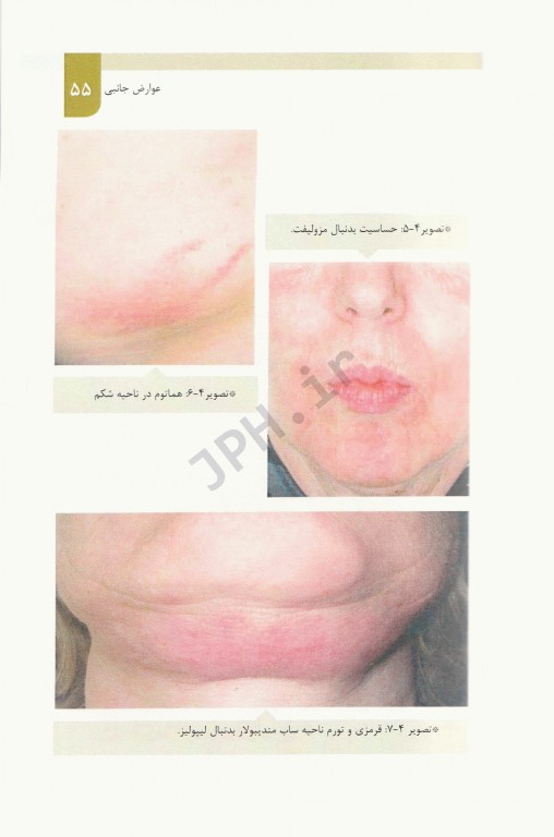 اطلس تصویری مزوتراپی