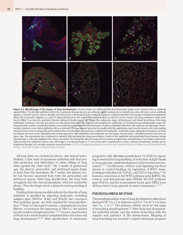 پزشکی تنفسی مورای و نادل ویراست هفتم | Murray & Nadel's Textbook of Respiratory Medicine 2021