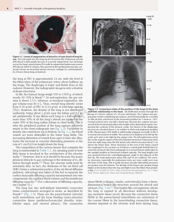 پزشکی تنفسی مورای و نادل ویراست هفتم | Murray & Nadel's Textbook of Respiratory Medicine 2021