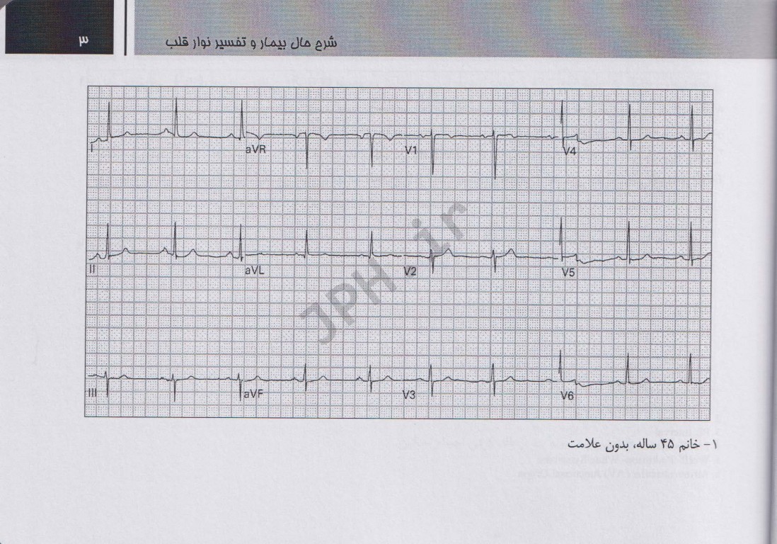 ECG برای پزشکان اورژانس جلد اول