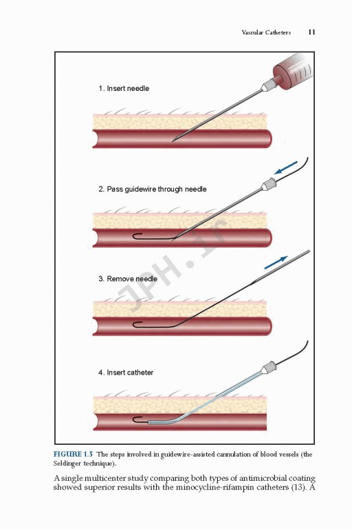 Marino's The ICU Book 2014 | آی سی یو پل مارینو ویراست چهارم