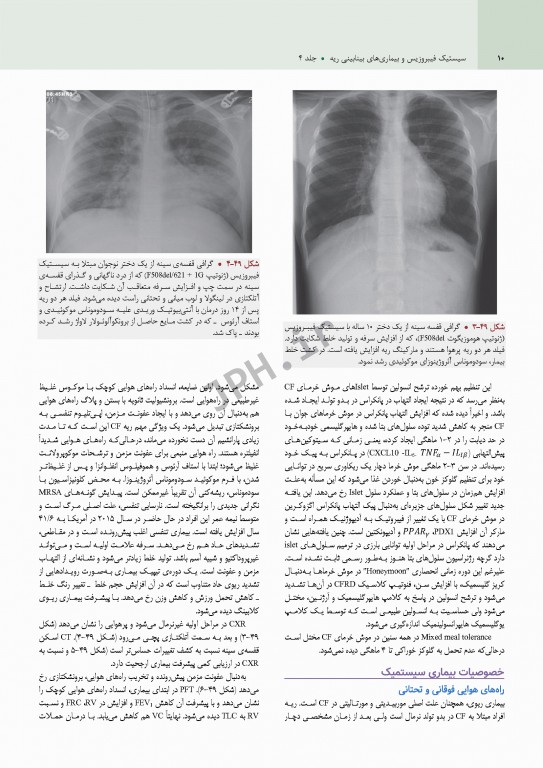 بیماری‌های ریوی کودکان کندیگ 2019 جلد4 سیستیک فیبروزیس و بیماری‌های بینابینی ریه