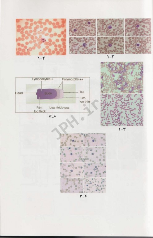 هماتولوژی عملی دیسی و لوئیس
