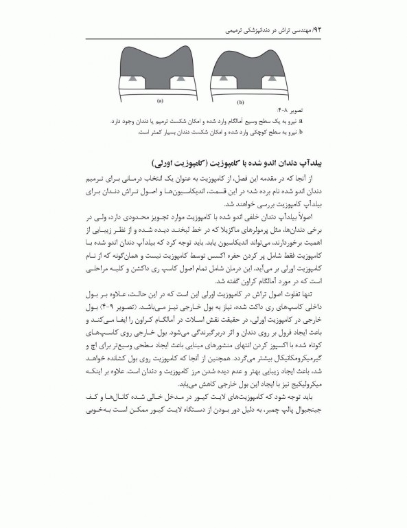 مهندسی تراش در دندانپزشکی ترمیمی