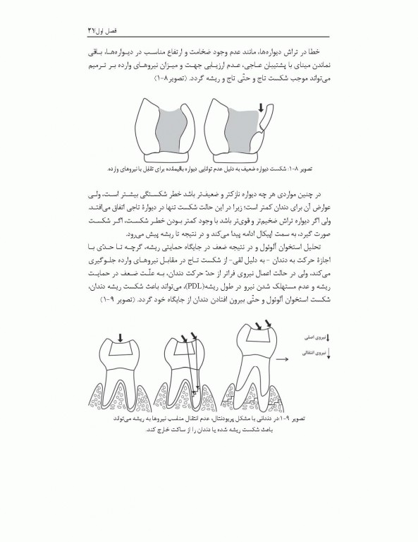 مهندسی تراش در دندانپزشکی ترمیمی